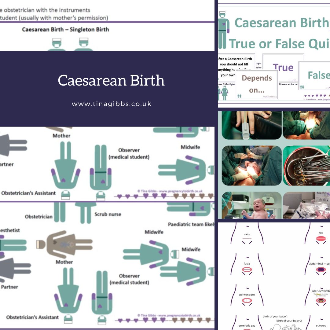 Caesarean Birth