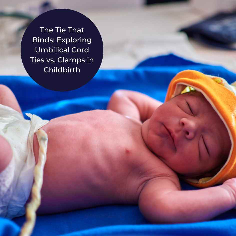 Umbilical Cord Ties or Clamps